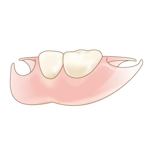 ノンクラスプ